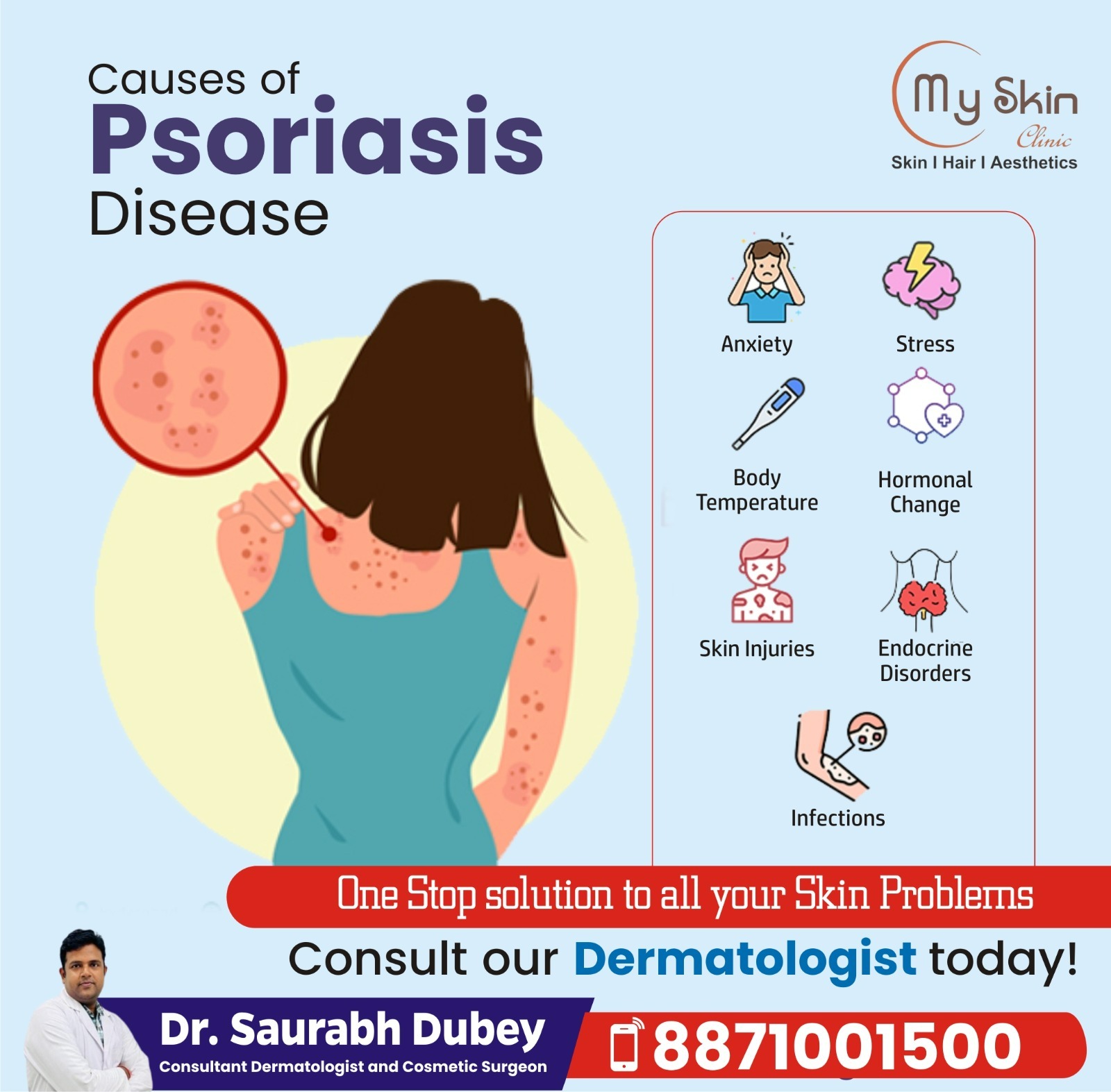 What is Psoriasis and its causes